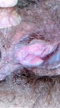 Nhỏ giọt ướt át