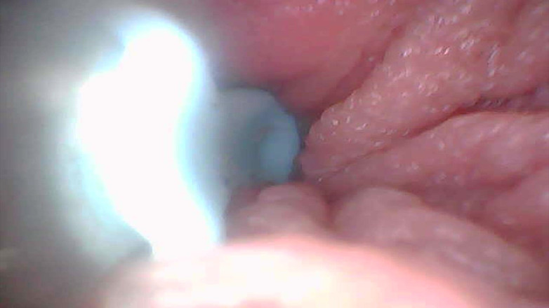 Twittiy: Vamos dar uma olhada na minha buceta suculenta juntos (câmera de...