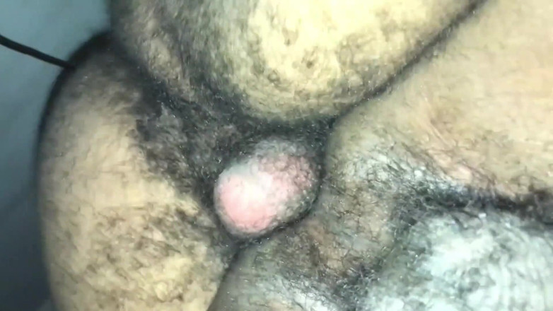 Couple 2 Black: Video 016 More Than a Year Without Trimming, Did You Like...