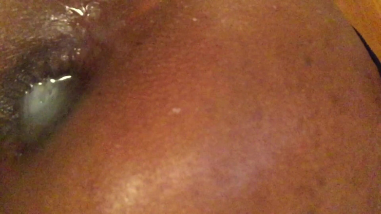 Ms300 Sarazia Exotic: Anal gaping with Ms300