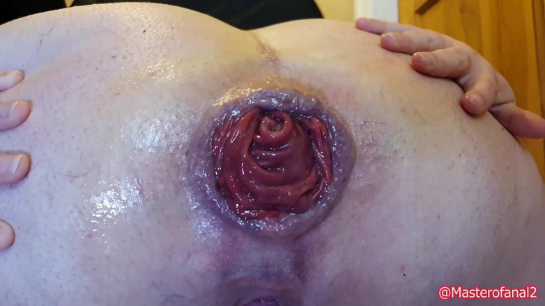 Violet Buttercup: Extreme anal with prolapsing
