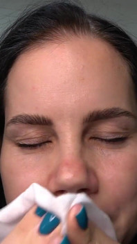Anna Sneezes and Blows Her Nose with a Pig Nose