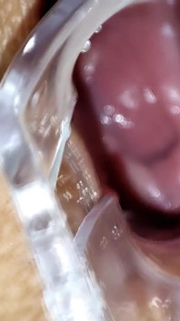 Orgasma squirtando dopo seni, esami ginecologici e anale