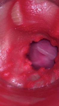 보지 속의 카메라: 보지에 사정하는 강력한 정액! 4K 더 많은 정자에서 최고의 내부 Asmr