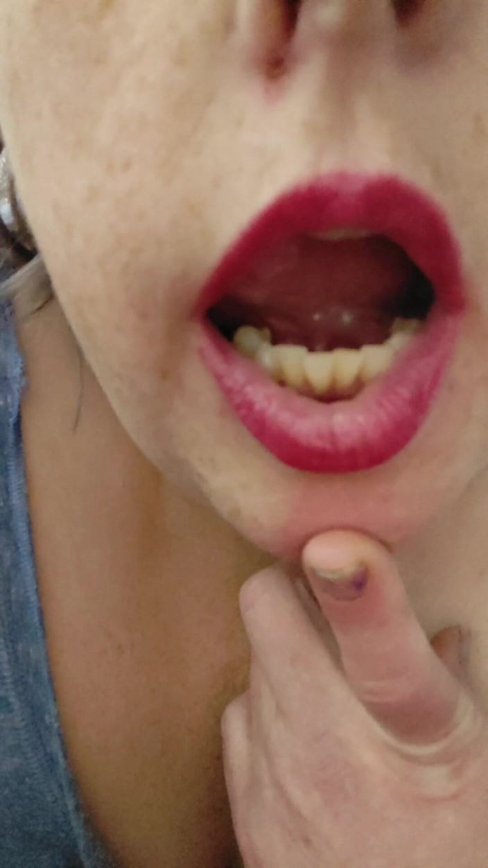 AngYourDirtyCanadian: Playing with My Tongue