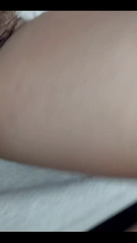 Cạo lông hay không?