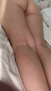 After Sex