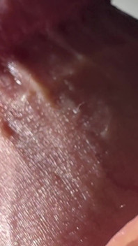 Penis Tropft