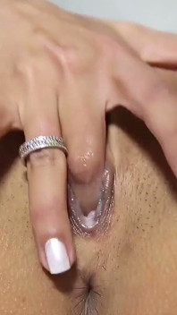 Apolonia detalles