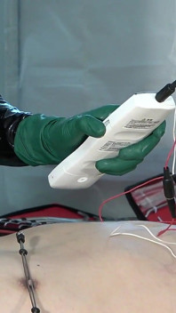 O femeie sadică doctoriță introduce un bougie în uretra pacientului și îi oferă un șoc electric, râzând