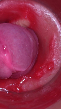 Super semen en la vagina. Excelente cámara interna. 4K