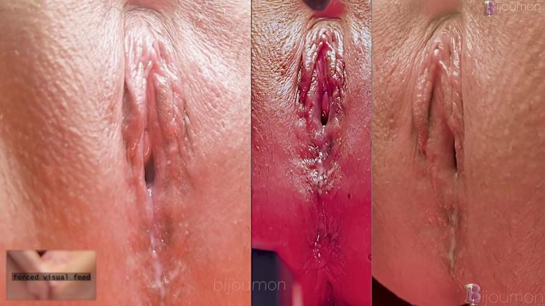 Bijoumon: Terapia di conversione lesbica