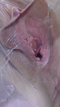 5 Lanet Vagina Yakından Çok Yayıldı