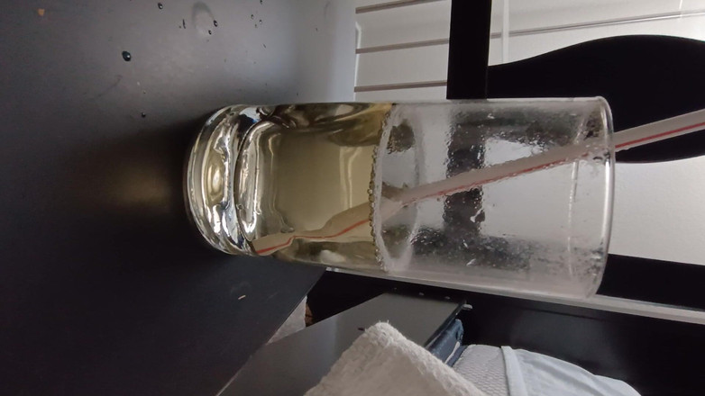 Brandon Lee: 水上运动和脱垂