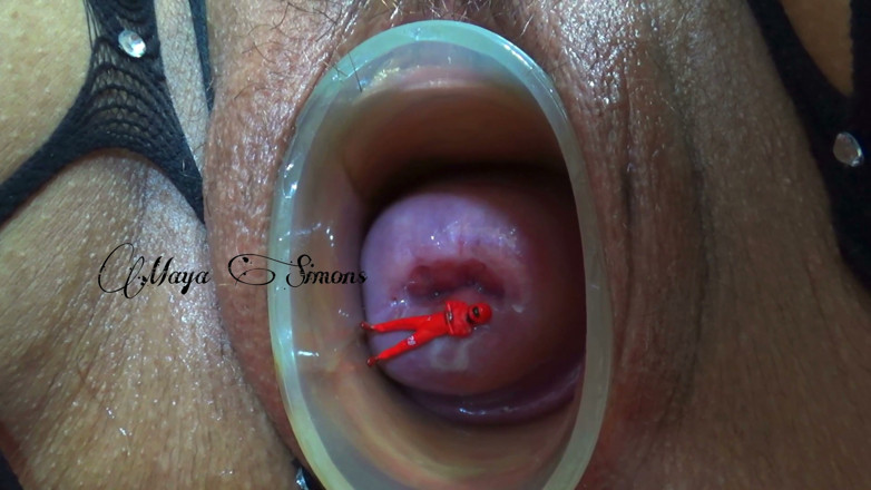 Maya Simons: This Is What My Cervix Looks Like After a Year...