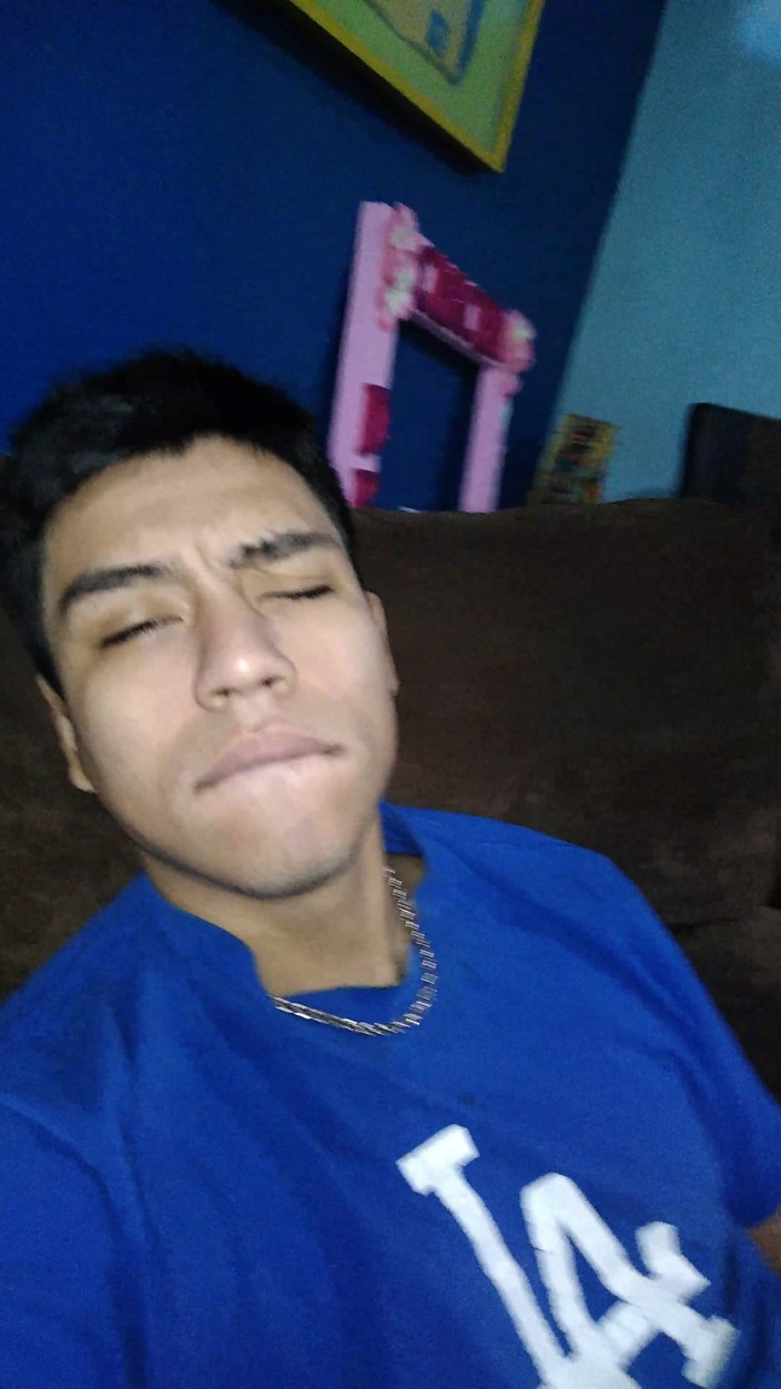 AlexAlejandro13: Fără păr