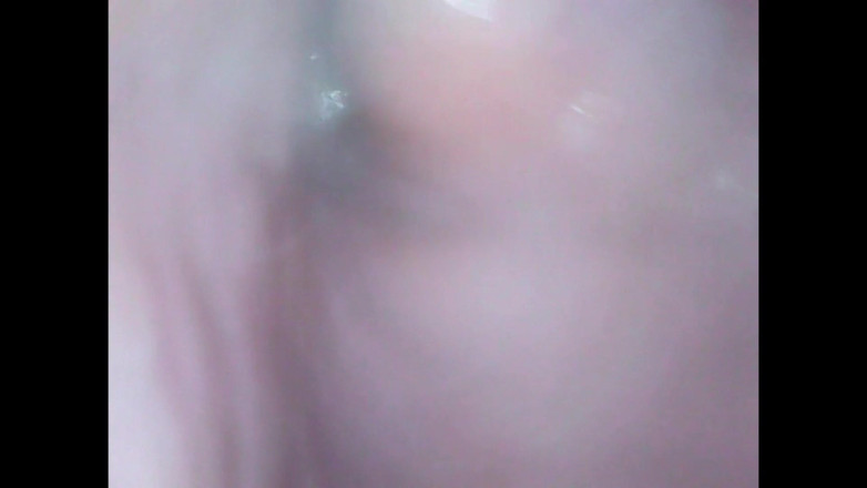 LizAngel: Endoscope in my vagina again