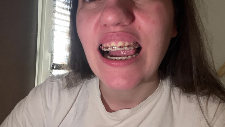 NicoleRay: 用舌头舔牙套