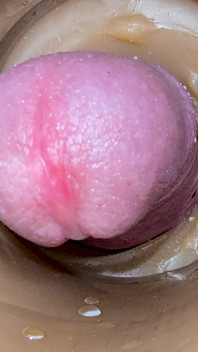 Camera Inside Deep Captures Huge Ejaculation of Sperm 2 Times