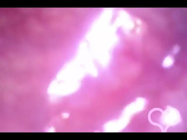 Lina Free: Endoscope anal dans mon colon transvers !