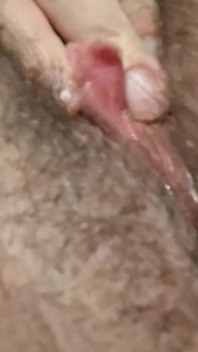 Melancap Munha Hairy Pussy