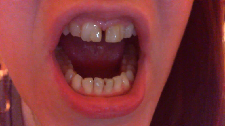 Nicoletta Embassi: Devoran fetiche de dientes