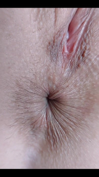 My Little Eye Is Winking at You! Would You Like to Lick It?