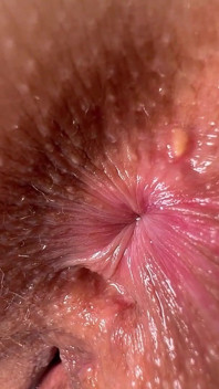 Cute Russian Girl Is Changing in Auto Anal Gaping!