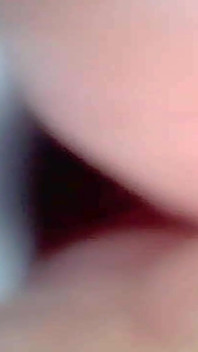Cámara De Endoscopio Captura Momentos De Eyaculación Masculina 4K