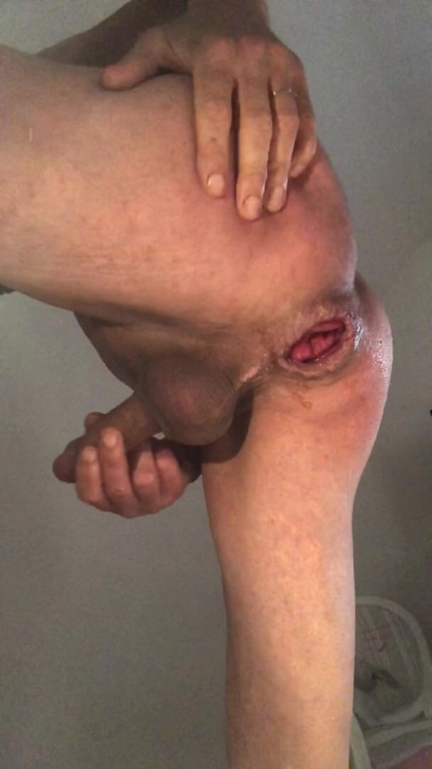 Jardinsecret346: Gape fisting anale, visualizzare lo sperma