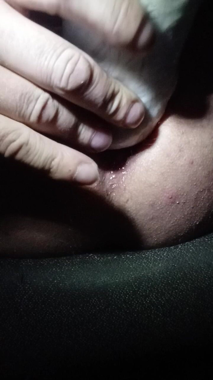 Haus86: Mengepalkan tangan