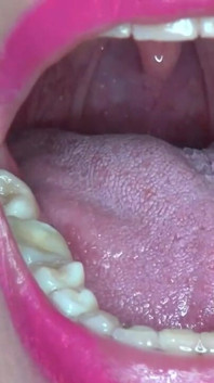 Showing My Super Power to You!!!! Super Uvula