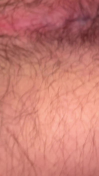 Close up Hairy Hole