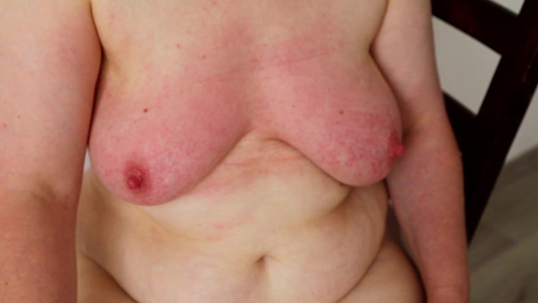 Bouncy Tits Action: Ortica e tette