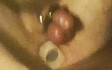 Okieotter: Anální kolík