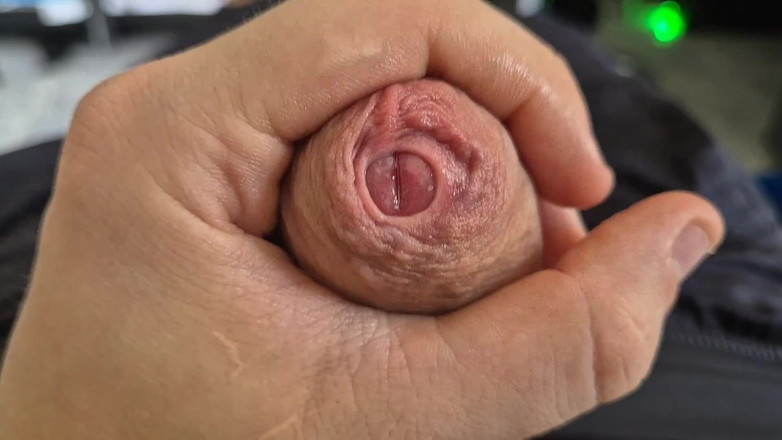 GloomyChase977: तंग बिना खतना वाले फिमोसिस लंड ने क्लोज अप फैलाया! कच्चे चमड़ी का खेल