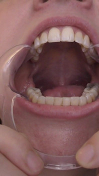 Gafas y gape: sesión de baba estirada por el espéculo dental de 11 minutos