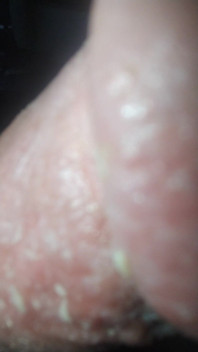 Smegma Big Uncut Smell