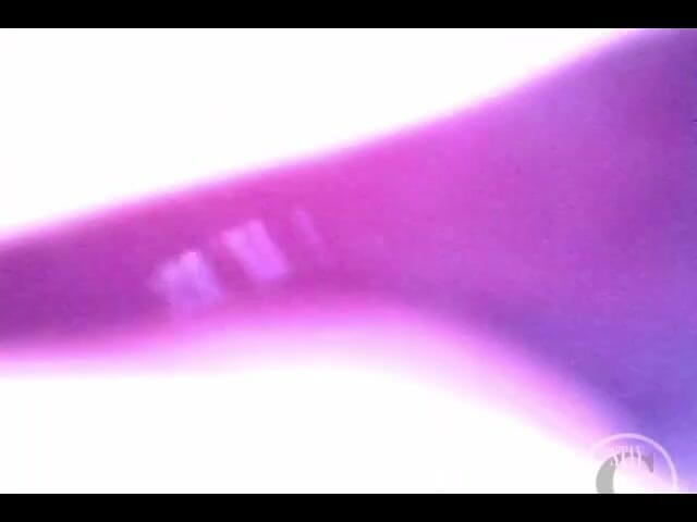 Lina Free: Endoscopio dentro en primer plano de mi jugoso culo fistado...