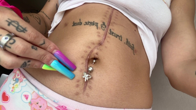 Nali Marie: Scar Fetish Belly Button Waist Tummy Skinny Teen Petite Flat...