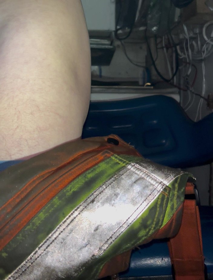 Se208: Snel flitsen pikwerk