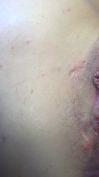 Fat Pumped Pussy Play