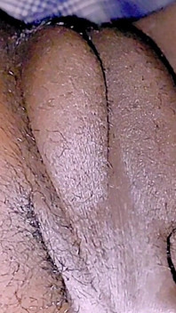 Zbytečný penis