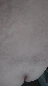 Video vyšetření držáku na krk pro zadek