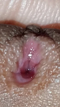 Vídeo aberto completo