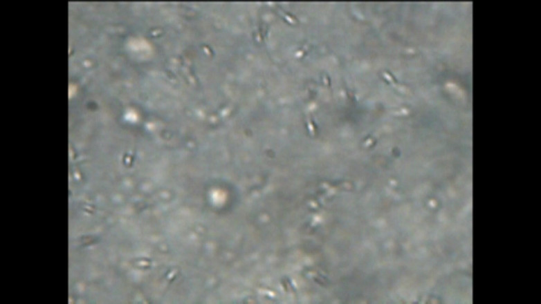 Mark Hannes: Fleshlight kongkek melancap dan sperma di bawah mikroskop