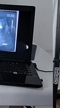 Gynecologist Performs Ultrasound Differently Next to the Cuckold