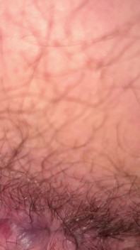 Close up Hairy Hole