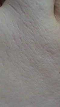 SSBBW up Close Body Exploration Stretch Marks