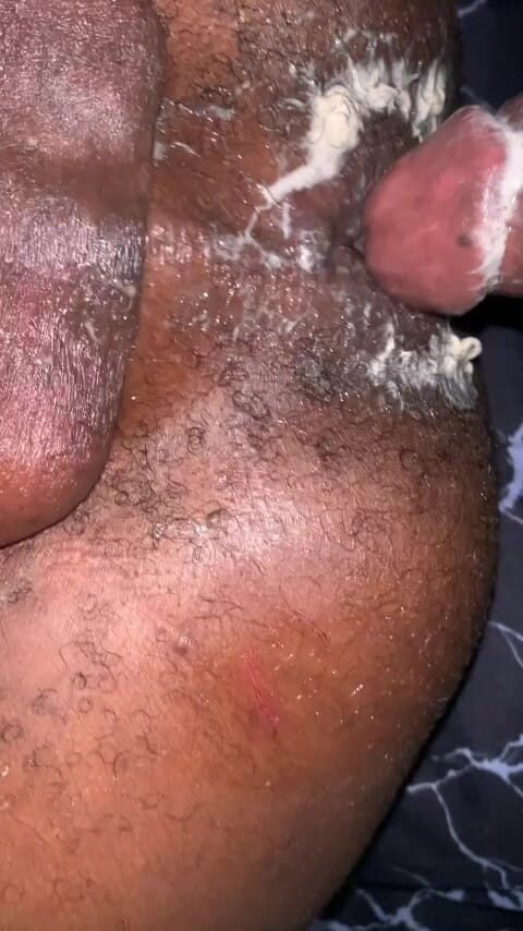 Honeyslim: Pantat saya berkrim